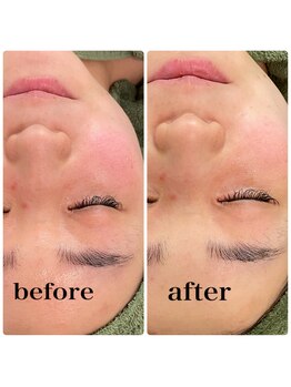 ラシック(Rachic)/クリスタルハーブパック☆