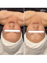 ビースキン(B SKIN)/CASMARA MASK