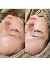 モンクラッシー(Mon classy)/美白効果も◎