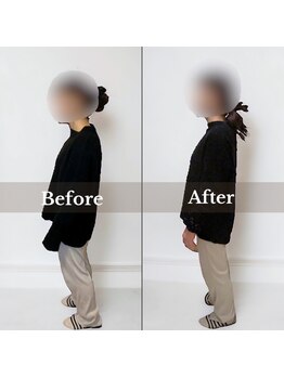 メイリリー(may lily)/◇施術イメージ　20代女性◇