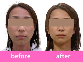 あぐり鍼灸整骨院/