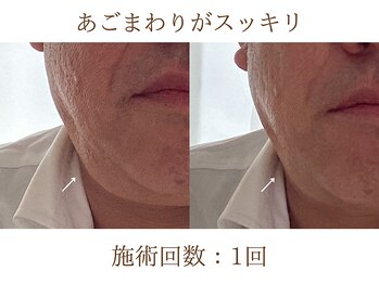 アンスリウム(ansrium)/