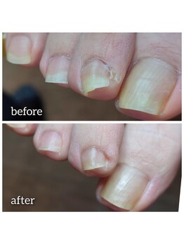 爪切り屋 足楽/