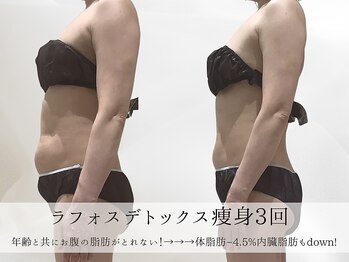 ミヨンラボ(miyon LABO)/ラフォスデトックス痩身3回