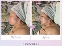 ルアナライフ(Luana Life)の雰囲気（渡韓しなくても韓国最新美容を体験できます♪）