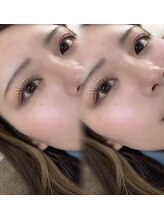 カリス ガーデン(Charis garden)/ラッシュリフト＊