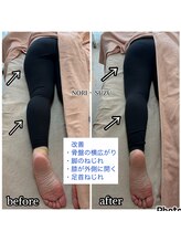 ノリスズ(NORI SUZU)/骨盤歪み・小尻・脚ねじれ改善