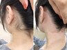 【後ろ姿美人に】うなじWAX脱毛