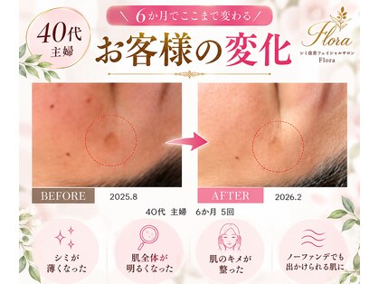 フローラ(FLORA)の写真