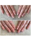nail care