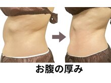 ニュートラル 池袋店(NEUTRAL)/施術結果【痩身/ダイエット】