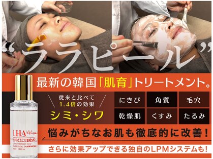 アネラ(ANELA)の写真