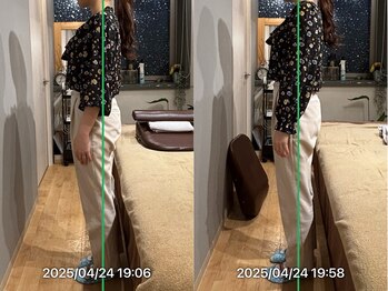 グレフル鍼灸接骨院 整体院 心斎橋/整体/肩こり/マッサージ/腰痛