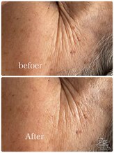 リッチベル(richbelle)/