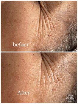 リッチベル(richbelle)/