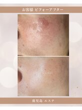 ミーラブ 鹿児島(miilove)/