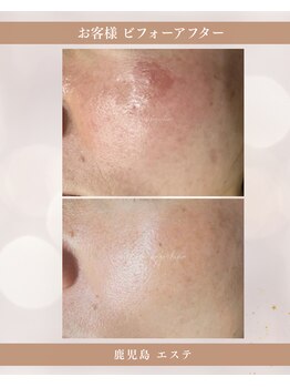 ミーラブ 鹿児島(miilove)/