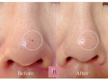 フォトビズの雰囲気（【シミ改善】スポット照射で効果絶大！痛みほぼナシ！シミ改善◎）