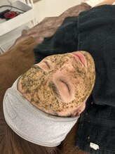 ジェルブラローズ(gerbera rose)/【肌質改善】ハーブピーリング