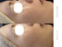 ソワ 恵比寿(soi)/ENVIRONエンビロンフルコース