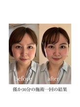 スパ 香炉/GUINOT美容機器VARフェイシャル