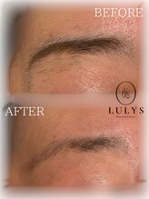 ルリス(LULYS)/女性眉毛脱毛