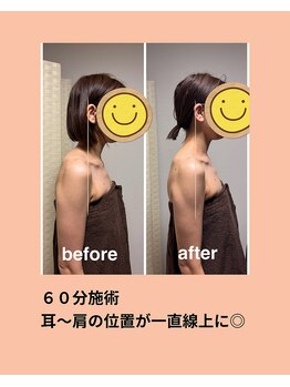 イーズリー(easily)/BEFORE→AFTER