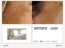 ボーテラボ 大宮(beaute LABO)