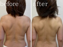 フォー(For...)/オイルリンパマッサージ/痩身