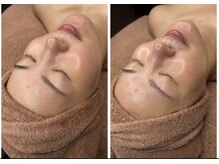 フォーユー(4U)/