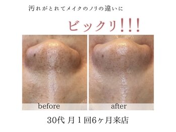 アネラ(Anela)/思ってるより！