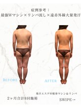 レセラ 銀座店(LE;SERA)/W痩身マシン×リンパ流し＆発汗