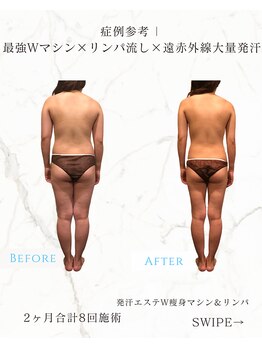 レセラ 銀座店(LE;SERA)/W痩身マシン×リンパ流し＆発汗