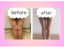 ヨサパーク ハーブ Melody亀山店(YOSA PARK)/痩身/ダイエット/リンパ/産後