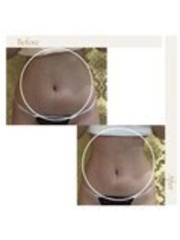 アイ アンド ネイルデイ 桂(EYE&NAIL DAY)/ビフォーアフター!