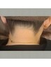 【おすすめメニュー】うなじWax脱毛