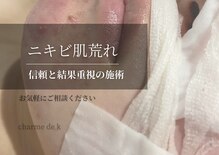 シャルム ド ケー(charme de k)