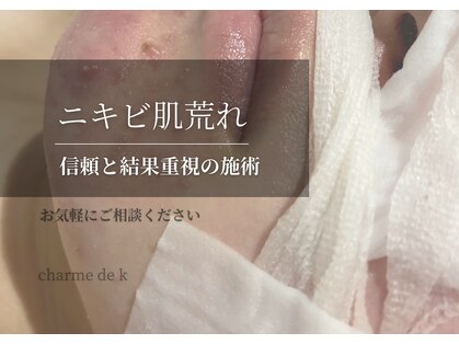 シャルム ド ケー(charme de k)の写真