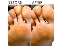 クオッカ(Quokka)の雰囲気（巻き爪/魚の目/たこ/陥入爪/肥厚爪/変形爪/巻き爪ケア/角質ケア）