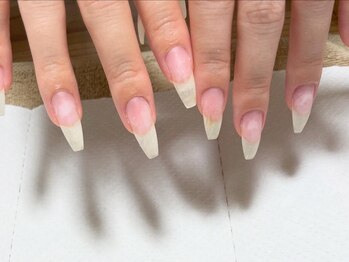 ネイルサロンアンドスクールラボ(LABO)の写真/ネイリストが自爪の悩み（深爪、巻き爪、割れやすい爪、そり爪等）を理想のネイルに♪