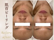 リボーン(Reborn)/【潤い補給】乾燥知らずのモチ肌