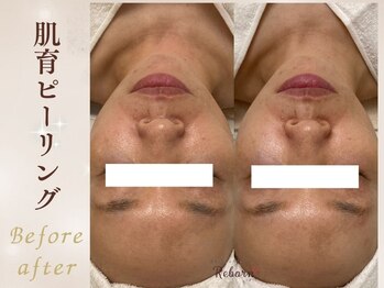 リボーン(Reborn)/【潤い補給】乾燥知らずのモチ肌