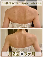 モカフォーブライダル(MOKA FOR BRIDAL)/