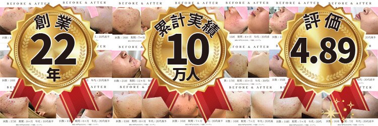 ロエヴェ(ROEWE)のサロンヘッダー