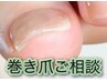 フットケア巻き爪ご相談クーポン