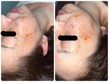 ルポ(Ropos)/60分のマジック