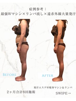 レセラ 銀座店(LE;SERA)/W痩身マシン×リンパ流し＆発汗