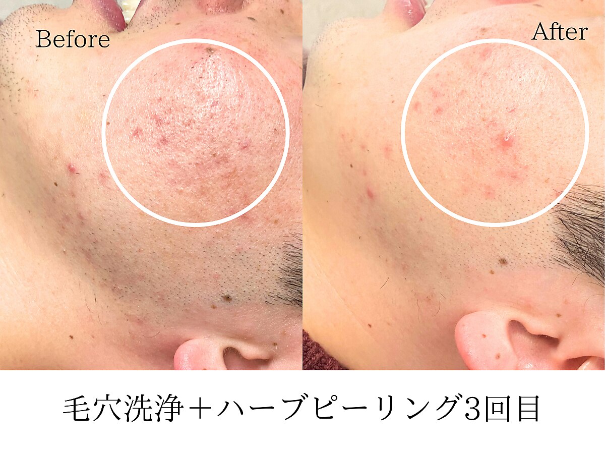 ミレア(Mire-A)｜ホットペッパービューティー