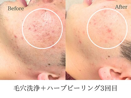 ミレア(Mire-A)の写真