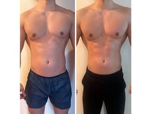ピエノローサ(Pieno Rosa)の雰囲気（【ハイパーナイフシリーズ】大人気痩身たった一度でこの効果っ！）